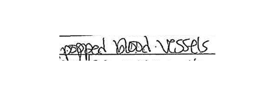 statement_0001_cb-fabiablert-rodriguez-2 Handwritten excerpt from CB's filing for Domestic Protective Order against Fabialbert Rodriguez. Handwritten text reads: "popped blood vessels"
